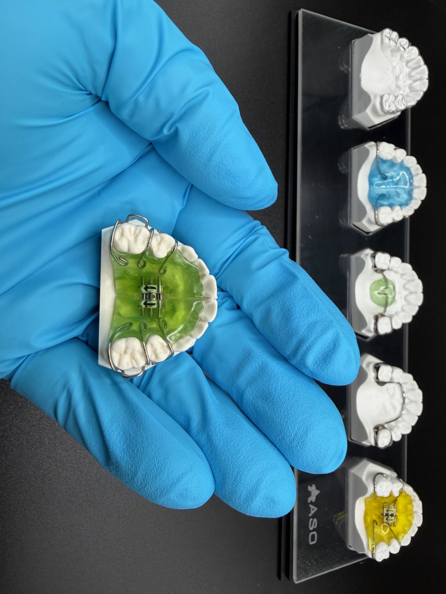 ASO miniature orthodontic models — hand-crafted with real dental resin