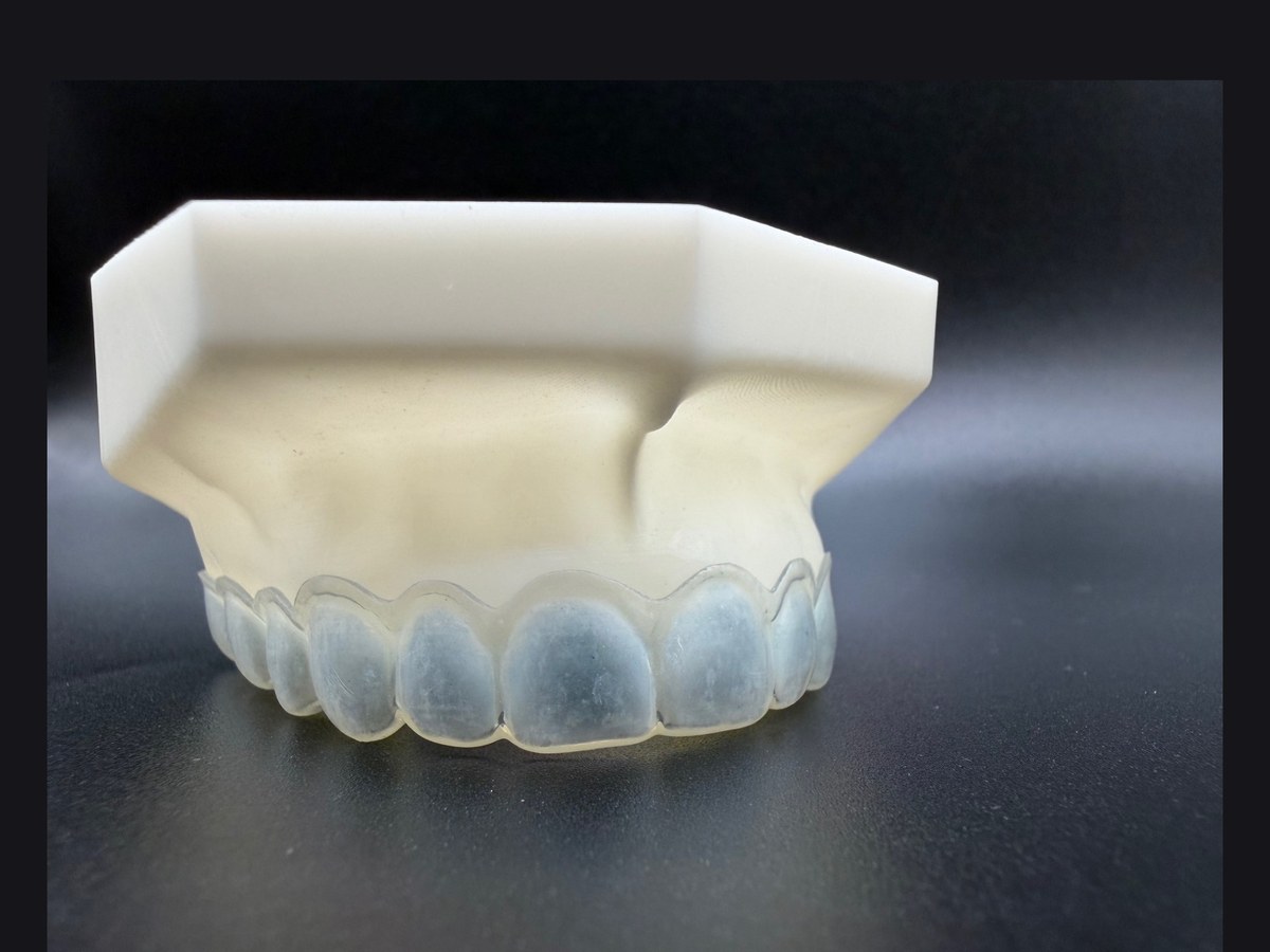 Bleaching Tray