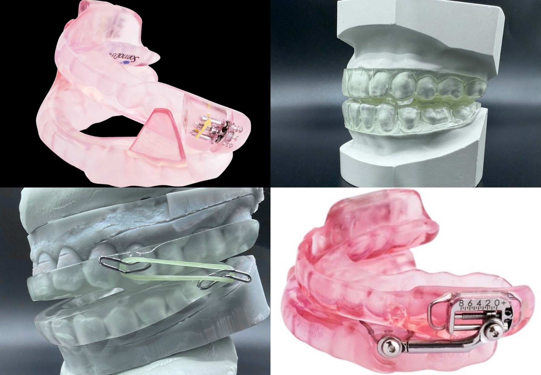 Custom sleep apnea and snoring appliances — SomnoDent and adjustable MAD designs