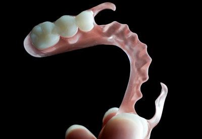 3D-printed flexible partial denture, close-up