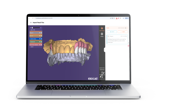 Flexible partial denture designed on screen