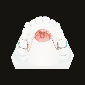 Nance Holding Arch (Reverse Type)