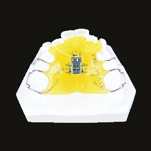 Three Way Expansion (Upper Fan Type)