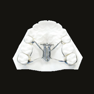 Rapid Expansion (Fan Type)