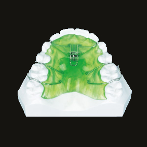 Expansion (Labial Movement)