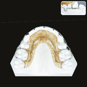 Wrap Around (Begg) Soldered Adams Clasps