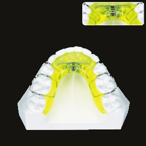 Expansion (Lower Fan Type)