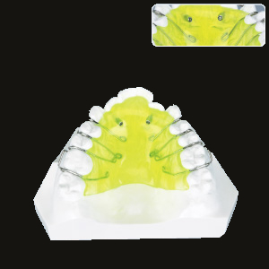 Expansion (Piston Spring)