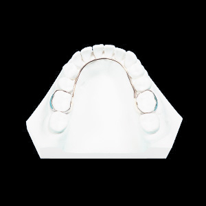 (a) Lingual Arch with Solder