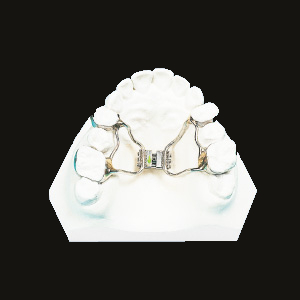 Rapid Expansion (Hyrax Type)