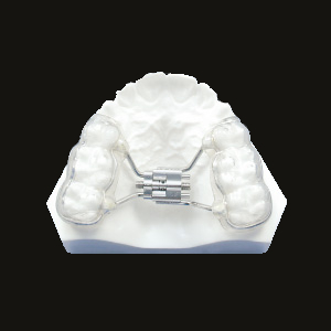 Rapid Expansion (Fan Type - Alt)