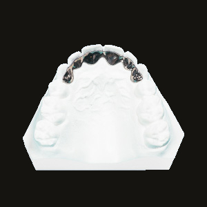 Metal Fixed Retainer