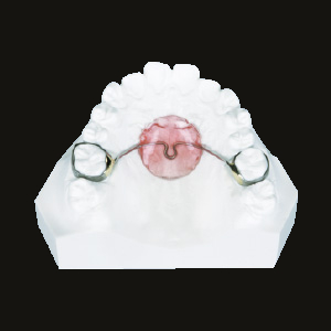 Nance Holding Arch (Straight Type)