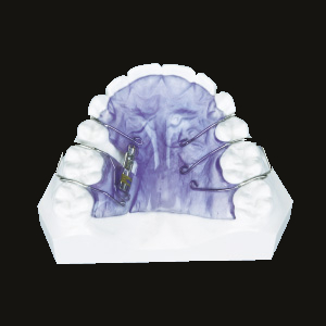 Traction Screw (Upper)