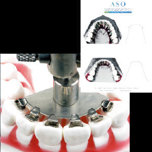 Positioning with Chart