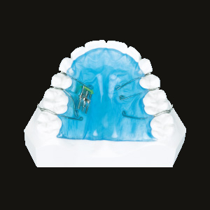 Expansion (Distal Movement)