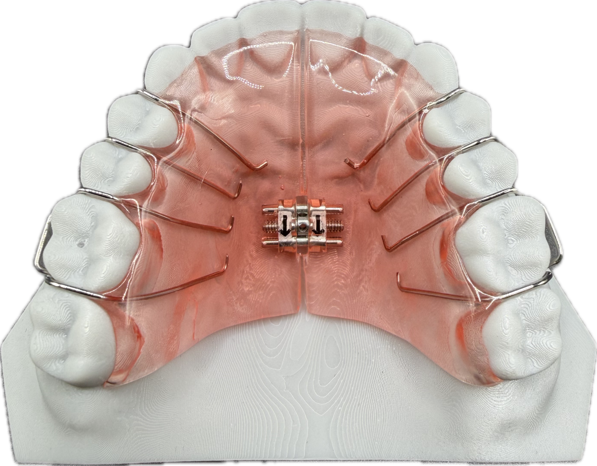 Plate Expansion